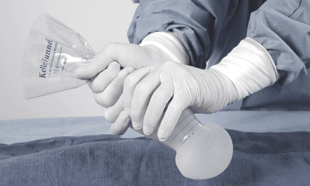 Funil de Keller para implante de próteses de silicone